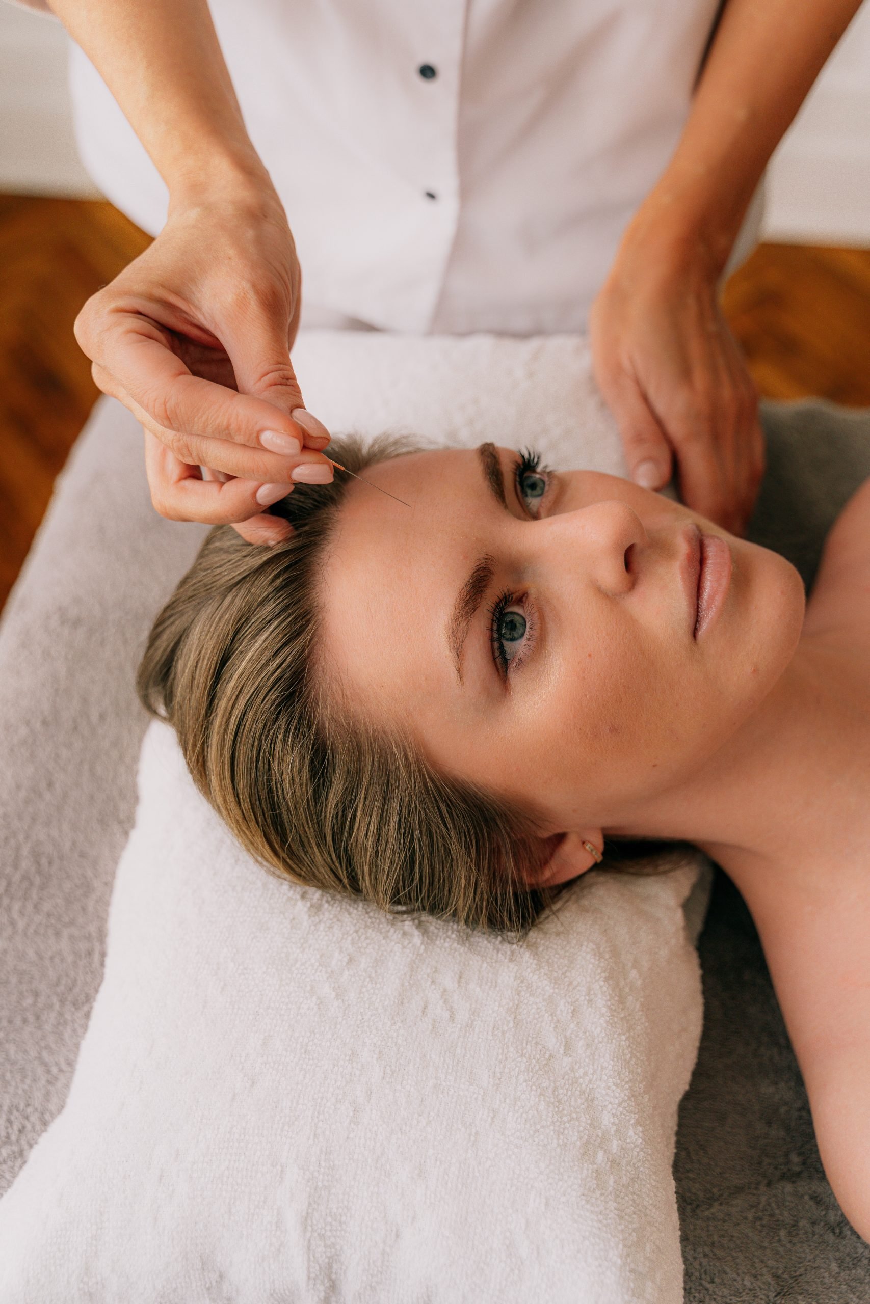 A woman receiving a gentle facial acupuncture session for skin regeneration and balance.